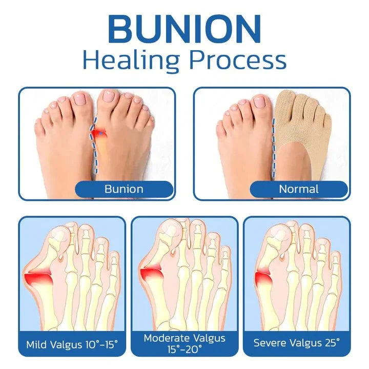 Anti Bunions Health Sock